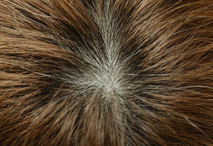 5 prodotti che possono riattivare i follicoli dei capelli